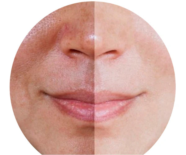 💋Crema  Despigmentante  BIOAQUA😎